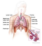 Respiratory anatomy; drawing shows right lung with upper, middle, and lower lobes; left lung with upper and lower lobes; and the trachea, bronchi, lymph nodes, and diaphragm. Inset shows bronchioles, alveoli, artery, and vein.