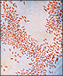 Photomicrograph of Haemophilus influenzae as seen using a Gram stain technique.