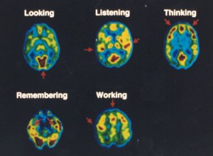 PET scans