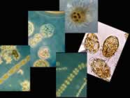 Winter Phytoplankton