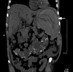 Appendix Figure.