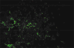  IFA reaction of a positive human serum to Rickettsia rickettsii