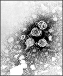 Transmission electron micrograph of hepatitis B virions, also known as Dane particles.