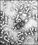 This electron micrograph reveals the presence of hepatitis-B virus HBV "Dane particles", or virions.