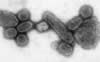 1918 Influenza Virus