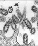 This transmission electron micrograph (TEM) of an ultra-thin specimen revealed some of the ultrastructural morphologic features seen in 1918 influenza virus virions. The prominent surface projections on the virions are composed of either the hemagglutinin, or neuraminidase type of glycoproteins. Composed of what looked like dots or tubules, was a dense envelope known as a “capsid”, which surrounded each virion’s nucleic acid constituents.