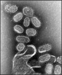 This negative stained transmission electron micrograph (TEM) shows recreated 1918 influenza virions that were collected from supernatants of 1918-infected Madin-Darby Canine Kidney (MDCK) cells cultures 18 hours after infection. 
