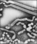 This negative-stained transmission electron micrograph (TEM) depicts the ultrastructural details of a number of influenza virus particles, or “virions”. A member of the taxonomic family Orthomyxoviridae, the influenza virus is a single-stranded RNA organism.