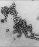 This transmission electron micrograph (TEM) depicted Russian influenza-A H1N1, (A/USSR/90/77 strain), virions, which had been magnified 189,000x.