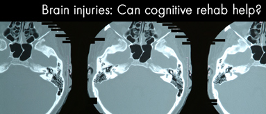 Brain injuries: Can cognitive rehab help?
