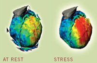 Photos of heart in action at rest and in stress