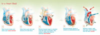 "In a Heartbeat" Diagram