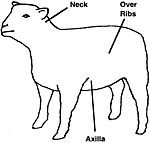 Needle for subcutaneous injections