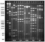 Figure. Restriction profiles of representative human adenovirus (Ad) genome types Ad7b (1), Ad7d2 (2), and Ad7h (3) after digestion with selected enzymes, BamHI, Sma I, BstEII, BglII, and BcII. DNA markers II ( HindIII) and III ( HindIII/EcoRI).