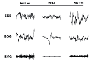 Figure 3. Chart showing strip chart deflections representing EEG, EOG, and EMG data for awake, REM, and NREM stages