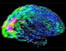 Mapping Brain Differences