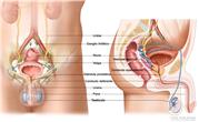 Anatomía del sistema reproductor y el sistema urinario masculino; muestra vistas frontales y laterales de los uréteres, los ganglios linfáticos, la vejiga, el recto, la próstata, la uretra, el conducto deferente, la vesícula seminal, el conducto eyaculatorio, el pene y los testículos.