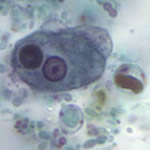 Entamoeba histolyica trophozoite