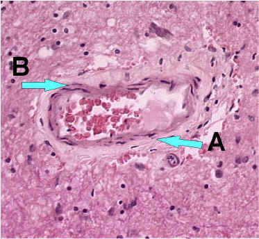 Blood vessel without inflammatory cells