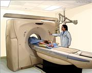Tomografía computadorizada (TC) del abdomen; el dibujo muestra al paciente en una camilla que se desliza hacia la máquina de TC, la cual toma radiografías de la parte interior del cuerpo.