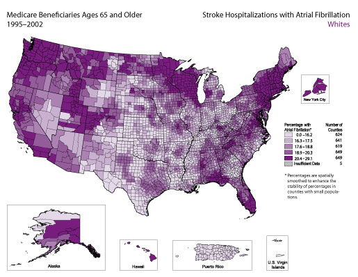 Map showing stroke hospitalization rates for medicare beneficiaries with atrial fibrillation for the white population. Refer to paragraph above titled Whites for a detailed explanatio of the map.