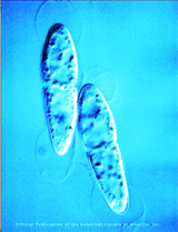 Artificially colored ascospores of the saprobic microfungus Aliquandostipite khaoyaiensis(Loculoascomycetes, Ascomycota).