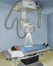 Radiografía del abdomen; el dibujo muestra al paciente en una camilla y se utilizan rayos-X para tomar imágenes de la parte interior del cuerpo.
