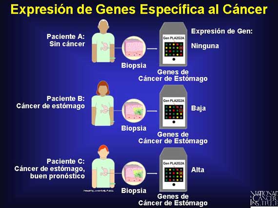 Expresión de Genes Específica al Cáncer