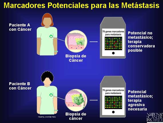 Marcadores Potenciales para las Metástasis