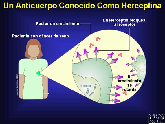 Un Anticuerpo Conocido Como Herceptina