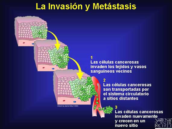 La Invasión y Metástasis