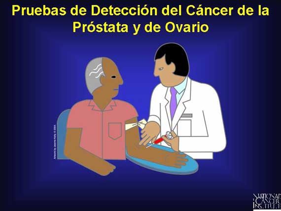 Pruebas de Detección del Cáncer de la Próstata y de Ovario