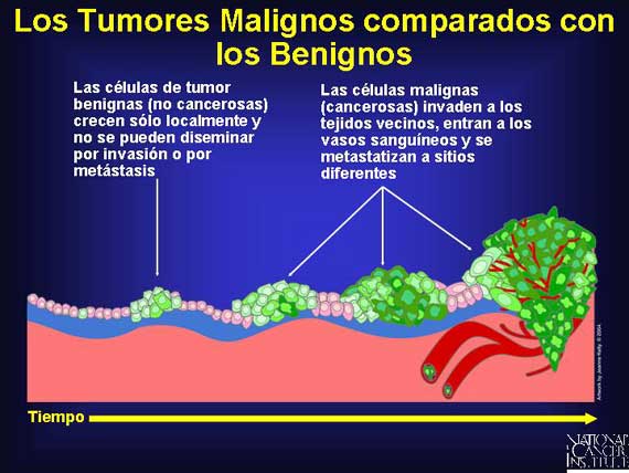 Los Tumores Malignos Comparados con los Benignos