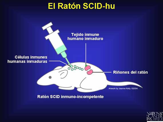 El Ratón SCID-hu