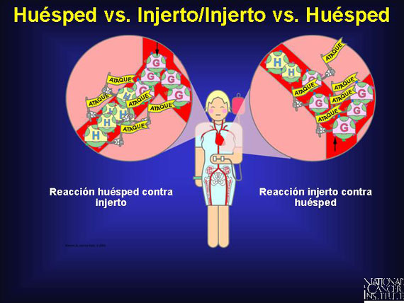 Huésped vs. Injerto/Injerto vs. Huésped