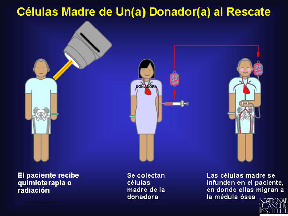 Células Madre de Un(a) Donador(a) al Rescate