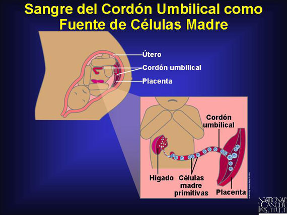 Sangre del Cordón Umbilical como Fuente de Células Madre