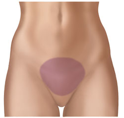 Radiation to the shaded area may cause urinary and bladder changes.