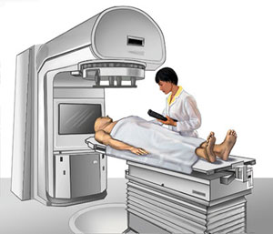 La radioterapia externa viene de una máquina. Esta dirige la radiación hacia el cáncer.