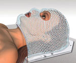 Si recibe radiación en la cabeza es posible que necesite una máscara.