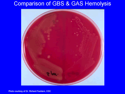 Comparison of GBS & GAS Hemolysis
