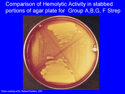Comparison of Hemolytic Activity in Stabbed portions of agar plate