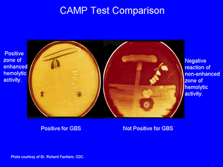 CAMP Test Comparison