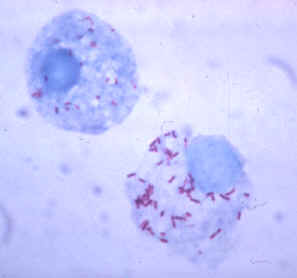 Gimenez stain of tick hemolymph cells infected with R. rickettsii