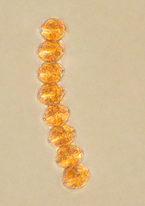 Chain of Alexandrium catenella
