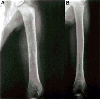 Before and after x-rays of an arm