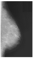 Digital Mammography Graphic