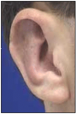 Ear Graphic