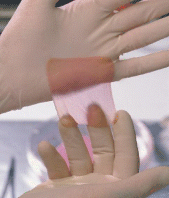 Wound and Burn Dressing