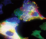 Cell movement, revealed here using fluorescent dyes (corner), is the focus of one of the glue grants. Courtesy of K. Donais and Donna Webb, University of Virginia School of Medicine.